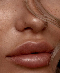 Lip Filler - How to get the perfect pout at PURE Cosmetics in Penrith
